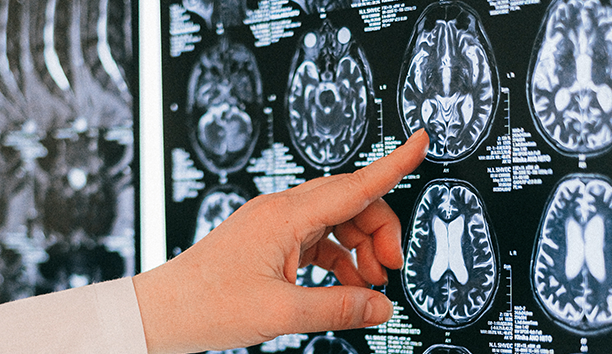 Webinar Library - Concussion webinar cover image